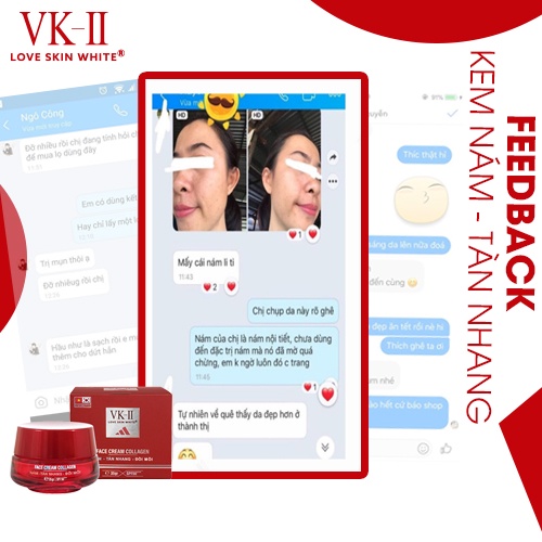 Kem dưỡng da mờ nám, tàn nhang, đồi mồi VK II Love Skin White Face Cream Collagen 35g