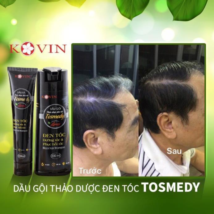 Dầu gội dược liệu đen tóc TOSMEDY - Công ty CP Dược TW Mediplantex - Đen tóc chỉ sau 01 lần gội. | BigBuy360 - bigbuy360.vn