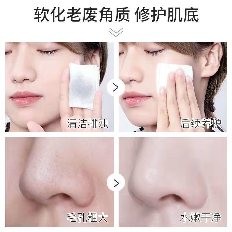 Gel than tre tía tô làm sạch sâu hiệu quả | BigBuy360 - bigbuy360.vn