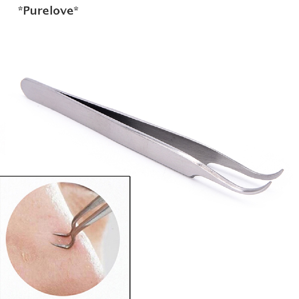 Kẹp Cong Lấy Mụn Đầu Đen Làm Sạch Da Mặt Tiện Lợi