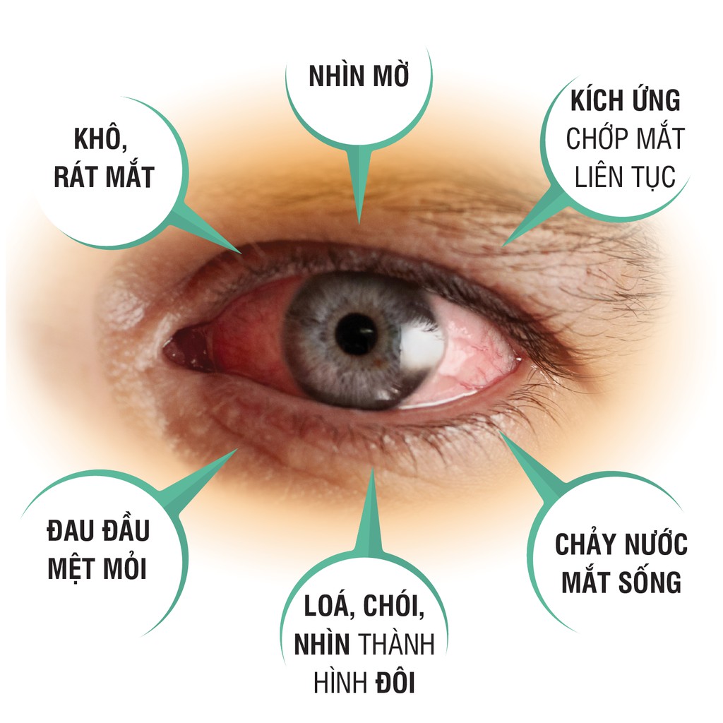 Wit - Bảo vệ võng mạc và thủy tinh thể. Tăng cường thị lực, giảm mờ, mỏi mắt (Lọ 30 Viên)