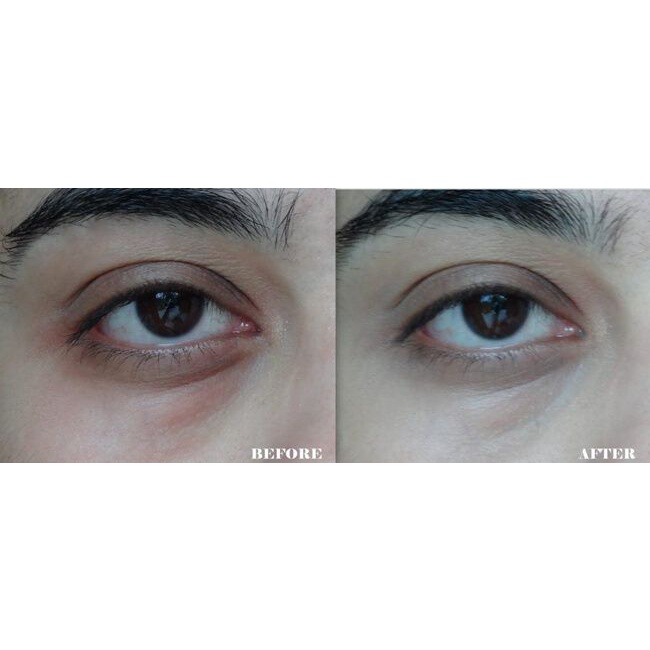 Kem Dưỡng Ngăn Ngừa Lão Hóa, Quầng Thâm Bọng Mắt Meishoku 30g | BigBuy360 - bigbuy360.vn