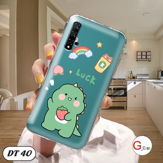 Ốp lưng dẻo cho Huawei Nova 5T