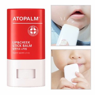Thanh lăn má và môi trị nẻ, viêm da cơ địa, dưỡng ẩm cho bé atopalm lip & cheek stick balm 12g