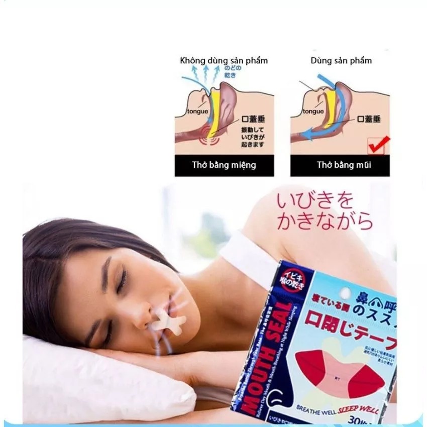 Gói 30 Miếng Dán Chống Ngáy Ngủ Mouth Seal M1, Miếng Dán Chống Hở Miệng Khi Ngủ Dành Cho Nam Và Nữ Dùng Được Cho Trẻ Em