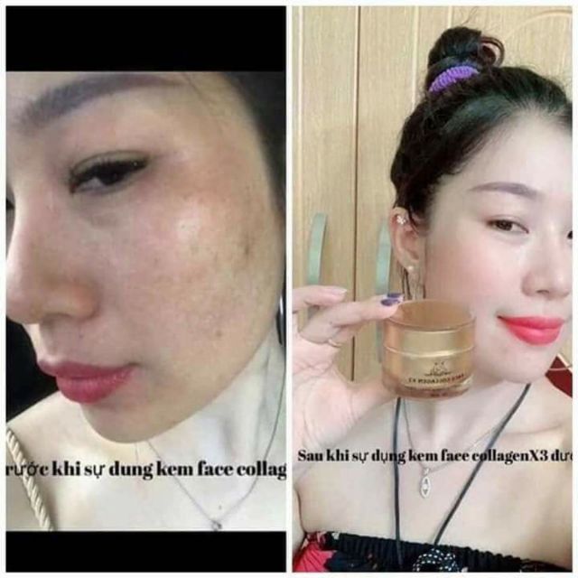 Kem face colagen X3 chính hãng có team check mã | BigBuy360 - bigbuy360.vn