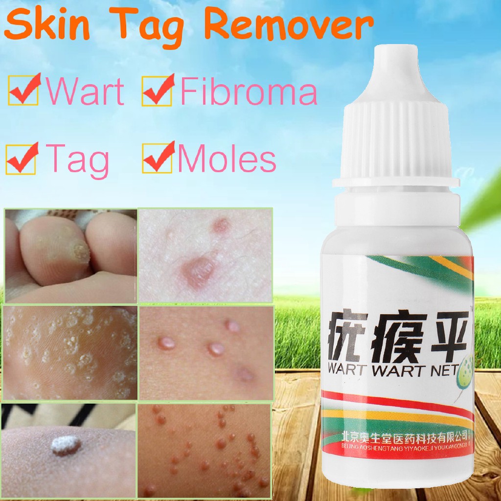 PL◇100% All Natural Skin Tag Remover 10ml - NEW ARRIVAL