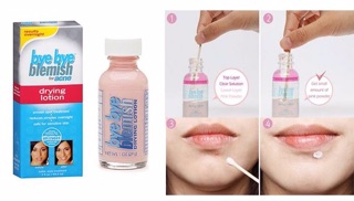 kem thuốc chấm mụn bye bye blemish