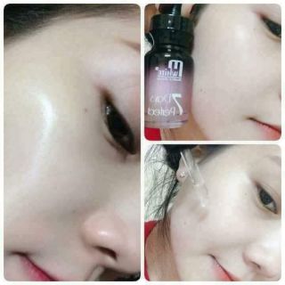 Serum 7 day Mwhite
