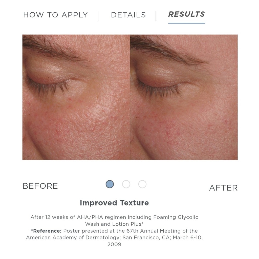 Sữa Dưỡng Ẩm/Lotion NeoStrata Glycolic Renewal Smoothing Lotion 10 AHA/NeoStrata Lotion Plus 15 AHA