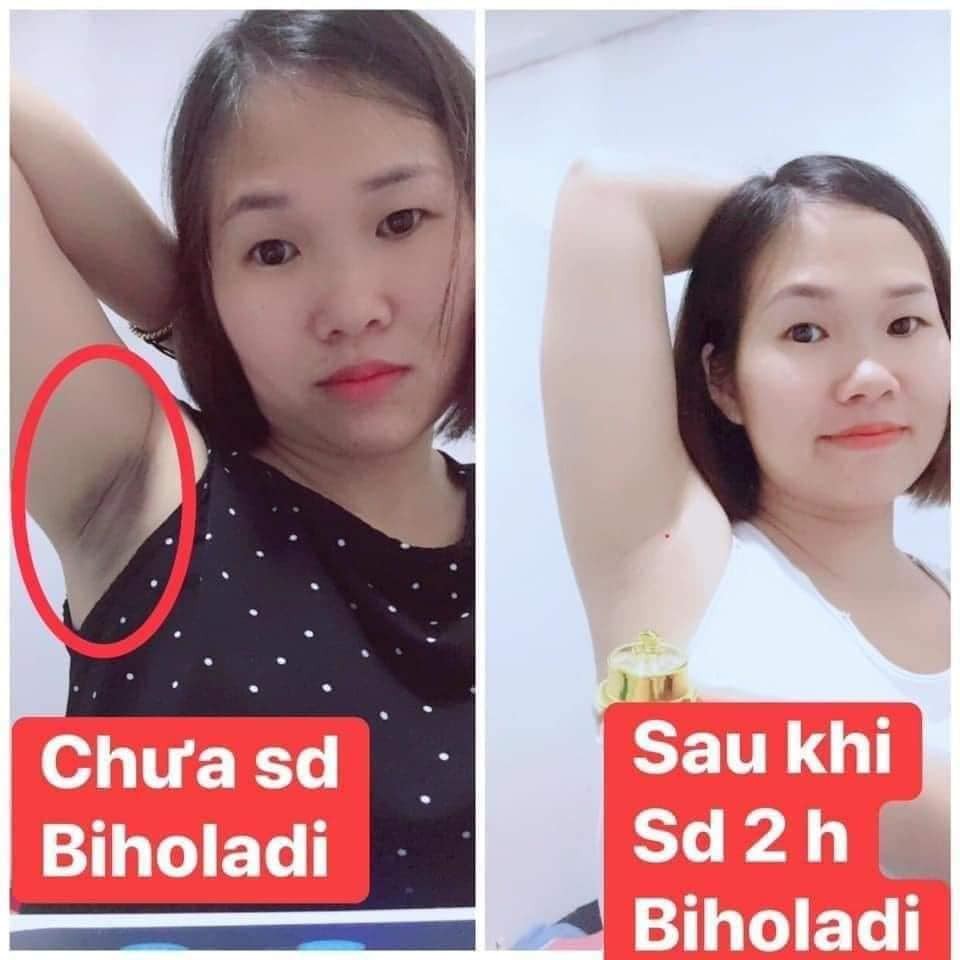 BIHO_LADI SIÊU DƯỠNG THÂM 5S ĐÁNH BAY THÂM NÁCH MÔNG BIKINI SIÊU DƯỠNG THÂM 5S (BIHO_LADY)