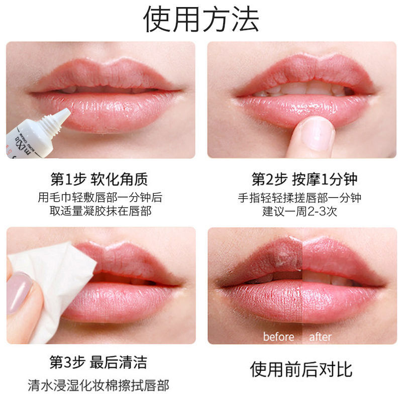 (hàng Mới Về) Gel Tẩy Tế Bào Chết Cho Môi Xiaoyuwan | BigBuy360 - bigbuy360.vn