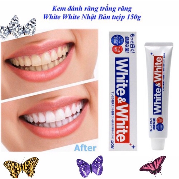 ⚠️FREESHIP⚠️ Kem đánh răng White & White Nhật Lion 150g