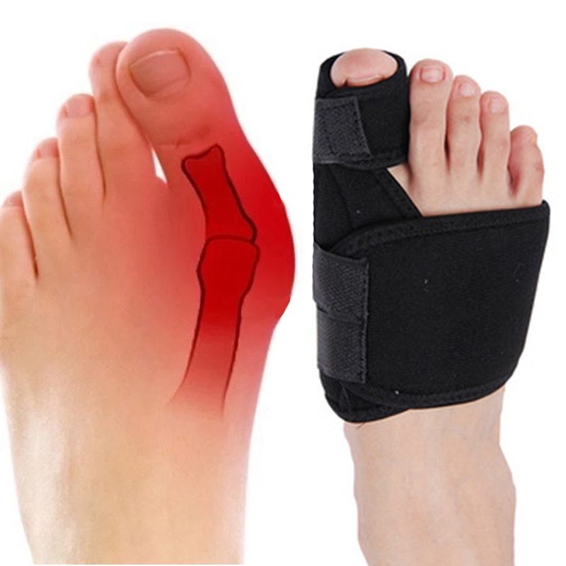 Set 2 Dụng Cụ Nẹp Chỉnh Hình Ngón Chân Mềm Mại Chăm Sóc Sức Khỏe