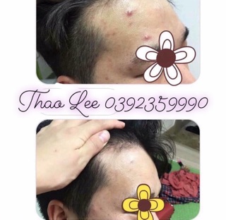 RED PEEP ( chiết sẵn )