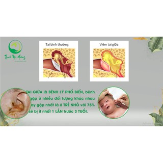 [CHÍNH HÃNG] Dung dịch nhỏ tai Thuần Mộc
