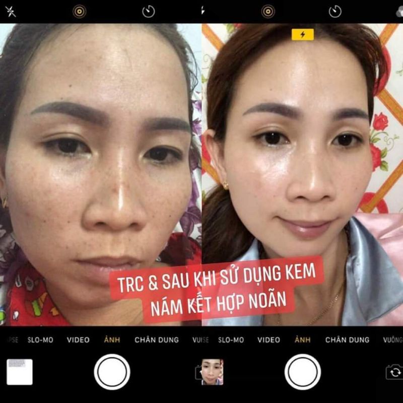 KEM NÁM SAFFRON 20GR HẢI ÂU VIỆT MẪU MỚI