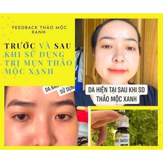 [SẴN HÀNG] Thảo Mộc Xanh 5ml