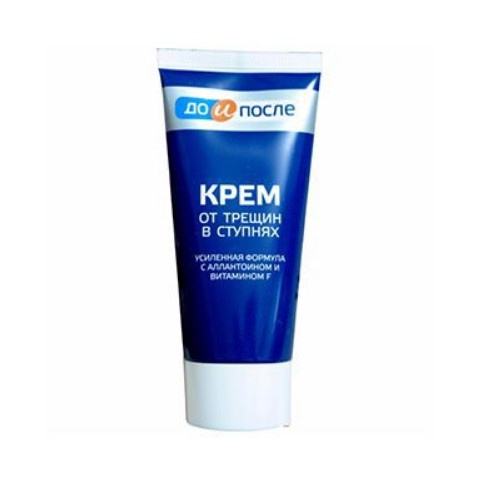 Kem nẻ gót chân Kpem Foot Cream Nga giảm nẻ chân nứt chân khô da chân dưỡng gót chân - [𝐓𝐚̣̆𝐧𝐠 𝐦𝐚́𝐲 𝐦𝐚𝐬𝐬𝐚𝐠𝐞 𝐦𝐚̣̆𝐭]