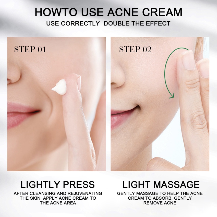 Kem Hỗ Trợ Giảm Mụn Trứng Cá Loại Bỏ Mụn Trứng Cá Kiềm Dầu Dưỡng Ẩm Làm Trắng Da Se Khít Lỗ Chân Lông