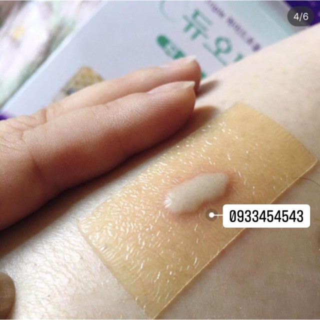 Miếng dán mụn hút mủ , dán vết thương Duoderm Extra