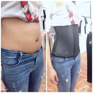 Đai định hình giảm eo latex