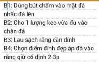 Bộ đính đá tại nhà ( tặng kèm keo và bút đính đá)