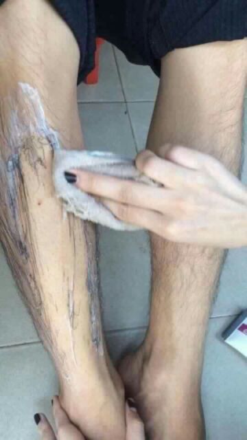 TRIỆT LÔNG TẨY LÔNG MWHITE CHÍNH HÃNG | BigBuy360 - bigbuy360.vn