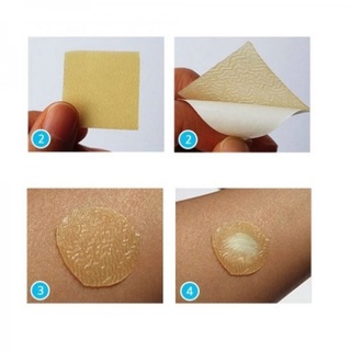 10 Miếng Dán Mụn DuoDerm