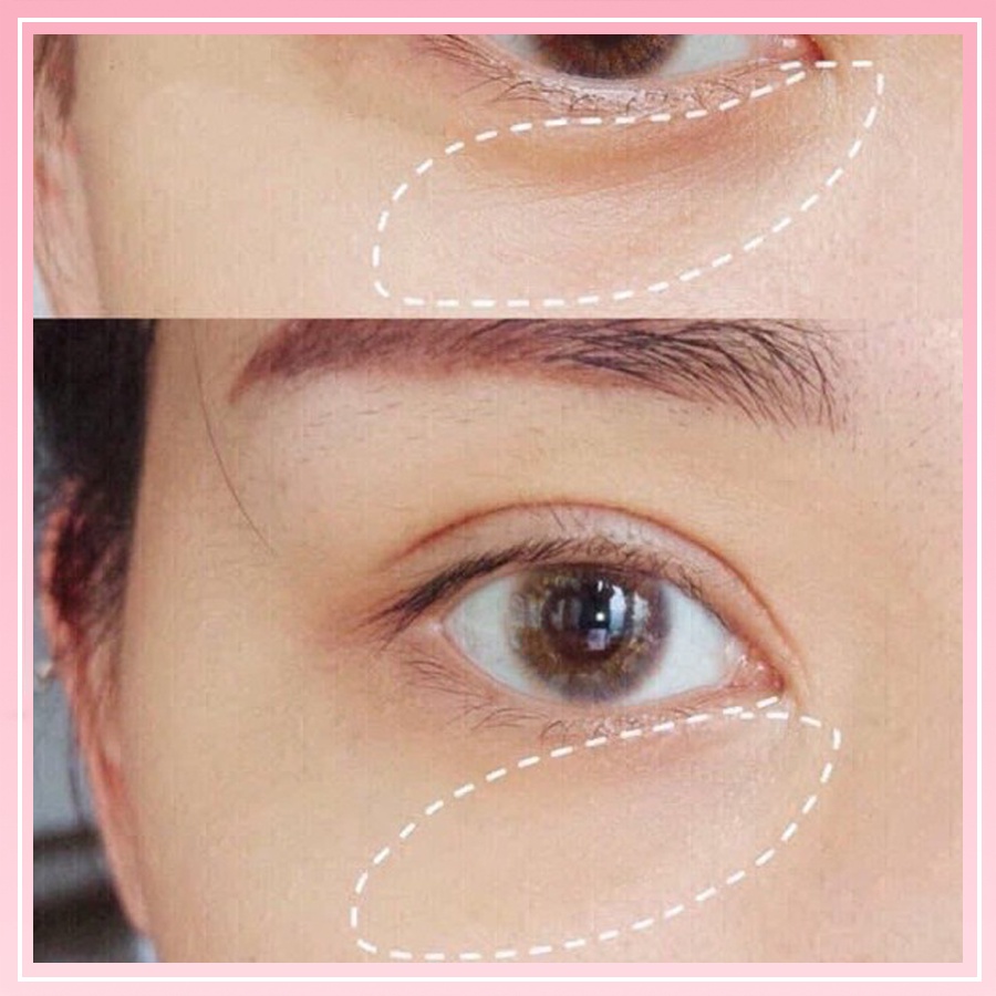 Kem Dưỡng Mắt Estee Đánh Tan Bọng Mắt, Giảm Thâm Quầng Mắt Và Nhăn Da Mắt Cho Da Mắt Luôn Tươi Trẻ - Én Cosmetic