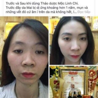 Thảo dược Mộc Linh Chi