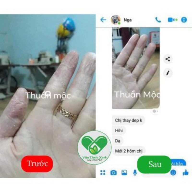 [Chính hãng] Cao Lá Thuần . Mộc Thanh Mộc . Hương - Kem Tri Rạn Da, Nứt Da