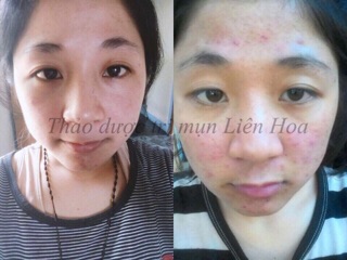 BỘT RỬA MẶT THẢO DƯỢC HANDMADE