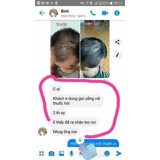 Dầu gội Hà Thủ Ô đen tóc,giảm rụng tóc kích thích mọc tóc