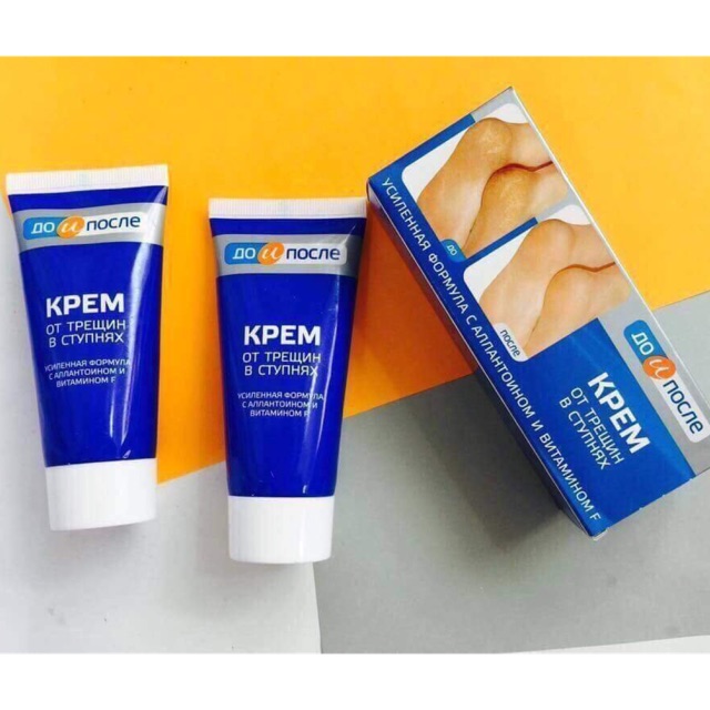 KEM NỨT GÓT CHÂN