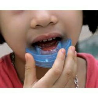 Dụng cụ niềng răng tại nhà