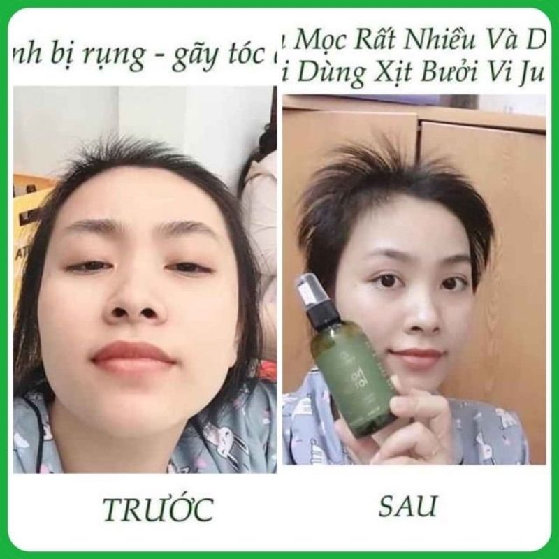 (Combo trị rụng tóc100%)Tinh dầu bưởi kích thích mọc tóc VIJULY