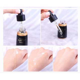 Serum Nám Dongsung Rannce 45ml