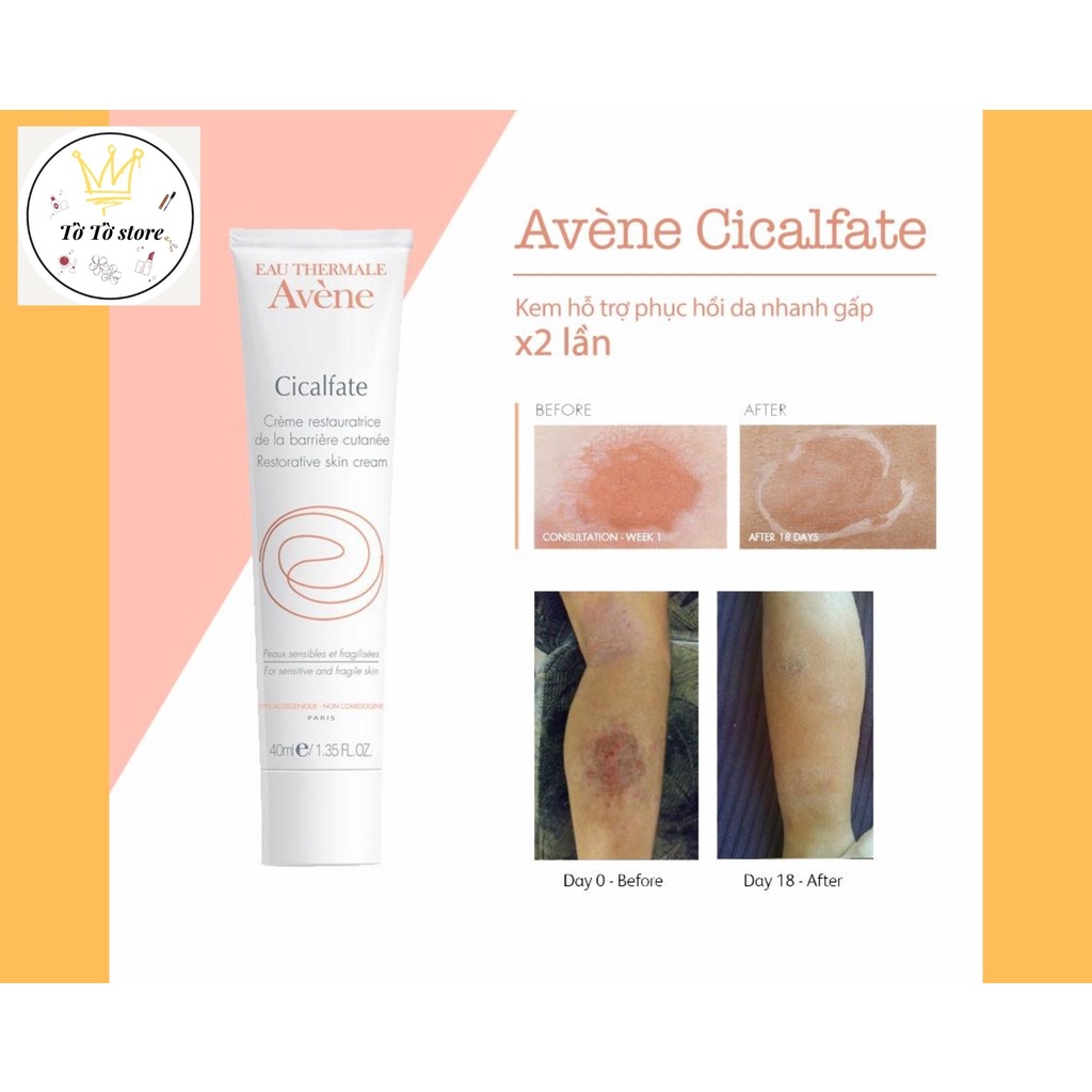 [BẢN PHÁP] Kem tái tạo hồi phục da Avene Cicalfate Repair Cream [CÓ ẢNH THẬT]