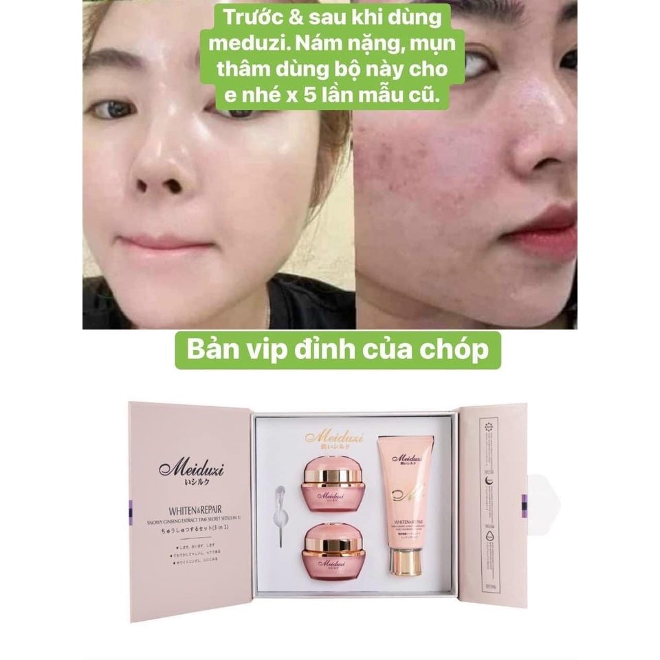 Bộ Kem MEIDUZI Nhật Bản, làm sạch nám tàn nhang và dưỡng trắng da