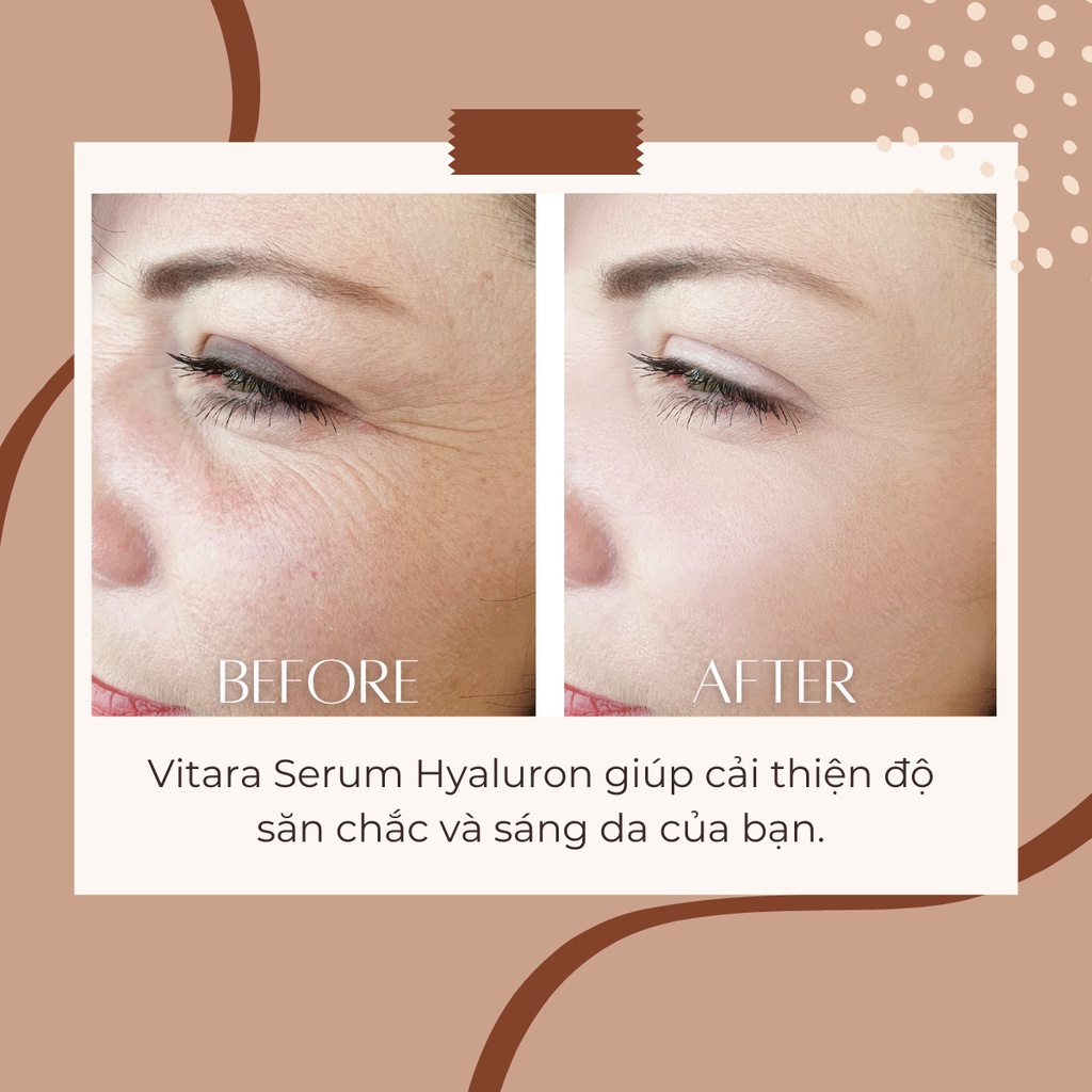 Serum Dưỡng Da Mặt Vitara Hyaluron 20g Giúp Giảm Lão Hóa Da , Giảm Nếp Nhăn , Vết Chân Chim Trên Da Mặt