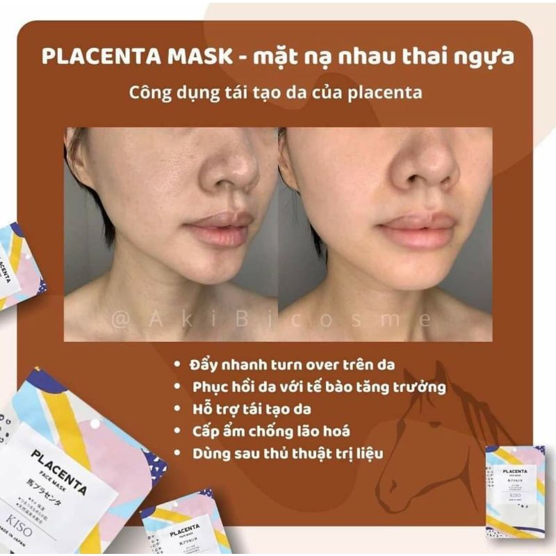 Mặt Nạ Tế Bào Gốc Cao Cấp Kiso Nhật Bản
