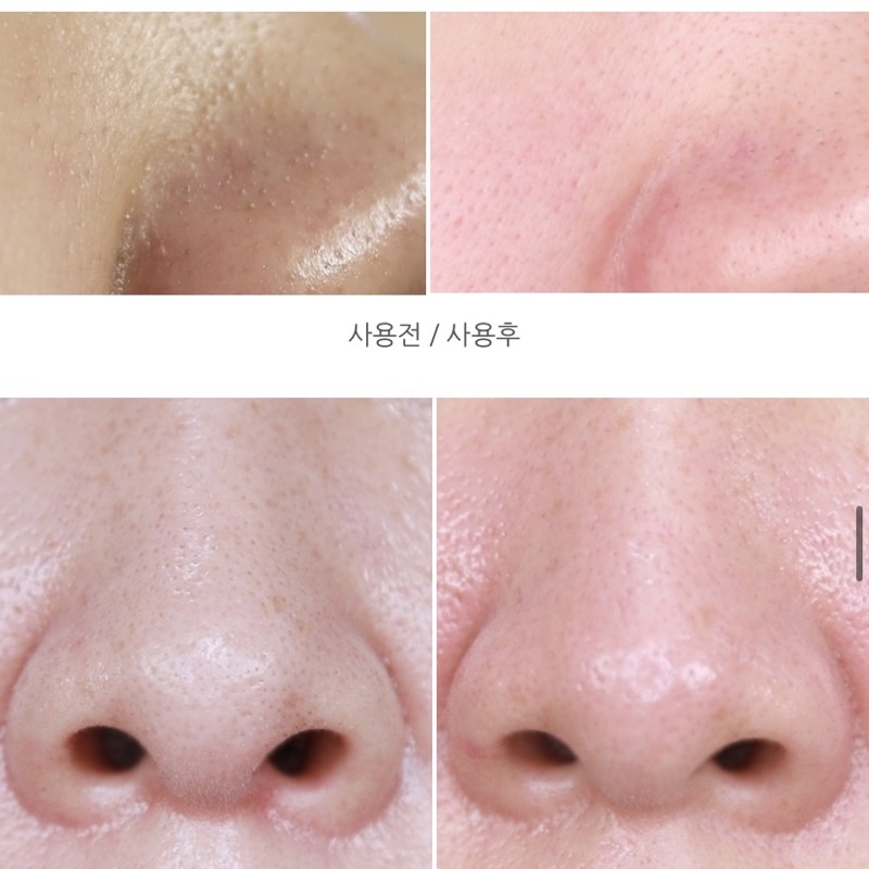 Miếng dán lột mụn đầu đen HATHERINE Pore Clear Black/ White/ Teatree Nose Strip