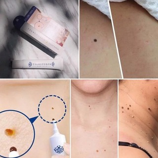 Gel Trị Mụn Thịt Mắt Tsubuporon