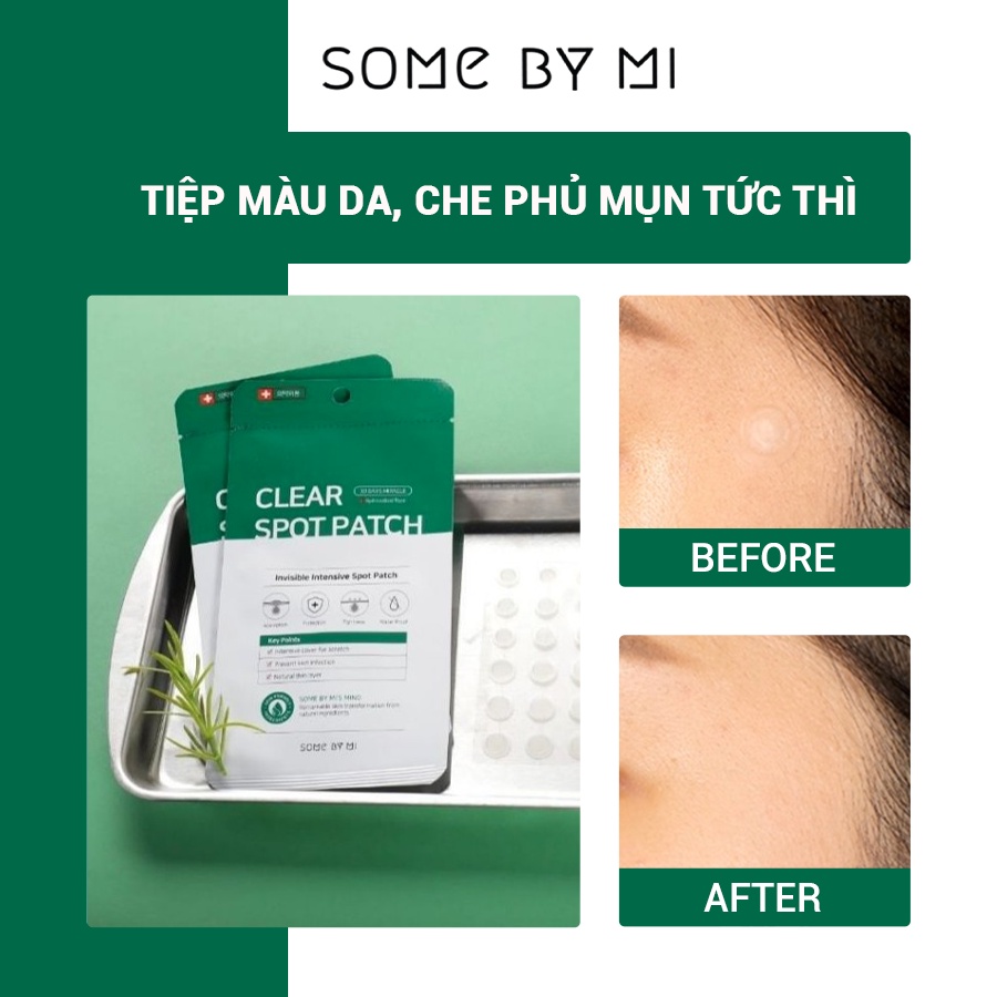 [Mã BMTTC60K giảm đến 60K đơn 50K] Miếng Dán Mụn Some By Mi Don't Pop It. Just Leave It 18Pcs 8g