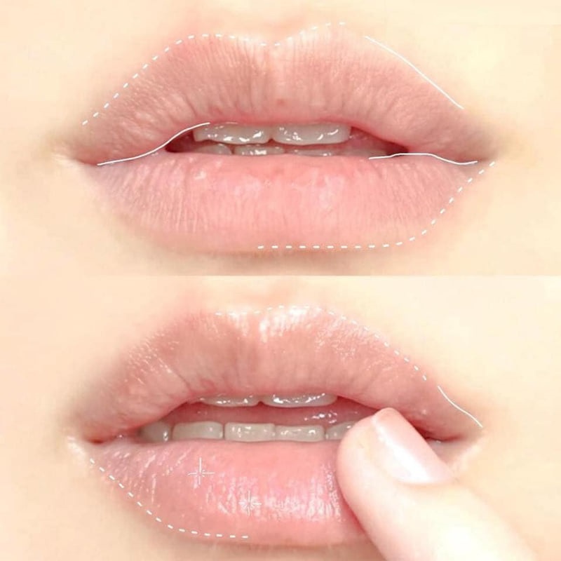 Son Dưỡng Môi Dạng Thỏi Vaseline Lip Therapy 4.8g