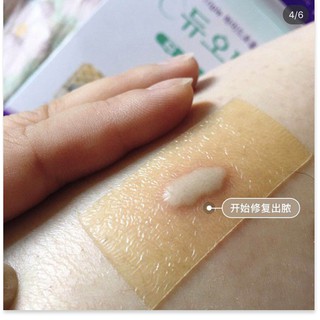 [Mã giảm giá mỹ phẩm chính hãng] Miếng Dán Mụn Duoderm Extra (1 miếng)