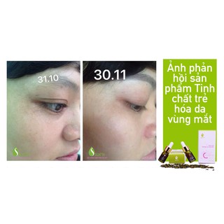 Tinh chất trẻ hóa vùng da mắt Suen
