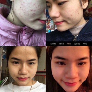 𝐂𝐀𝐎 𝐋𝐀́ 𝐍𝐀𝐌 (𝐇𝐔𝐘𝐄̂́𝐓 𝐓𝐇𝐀𝐍𝐇) 𝐋𝐎̣ 𝟓𝐌𝐋 𝐇𝐀𝐍𝐃𝐌𝐀𝐃𝐄