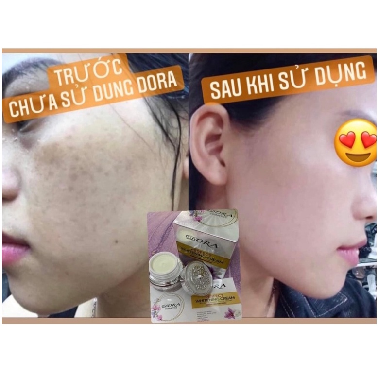 KEM DORA GIẢM TẤT CẢ DẤU HIỆU LÃO HÓA , NÂNG CƠ CHỐNG CHẢY XỆ